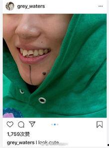 门牙缺失吃瓜,吃瓜也能吃出生活新滋味